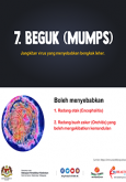 Beguk (Mumps) - infografik 7